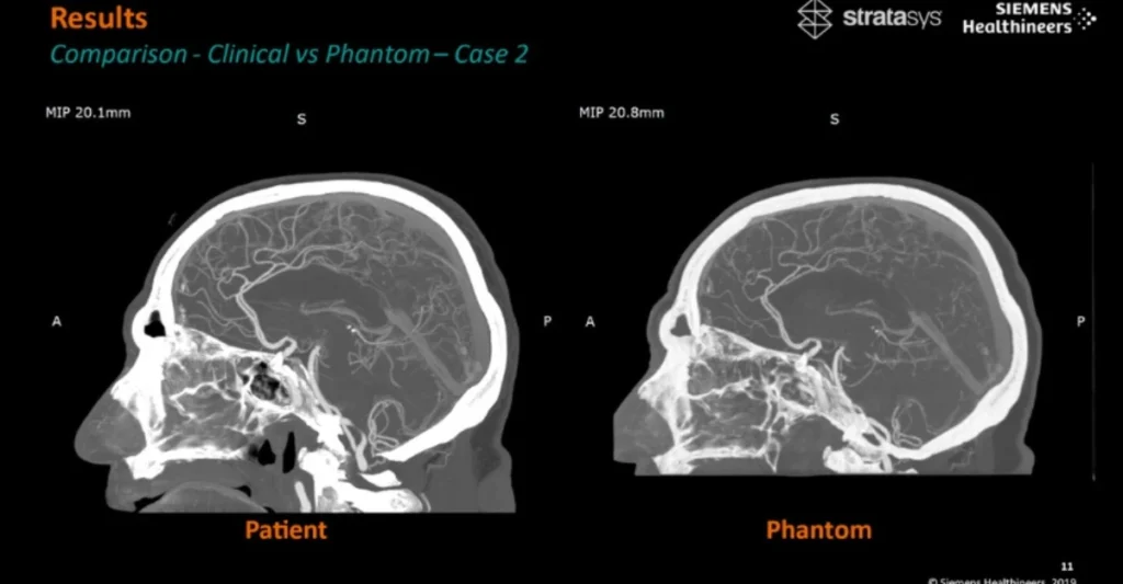 Breakthrough 3D Printed Phantoms Set New Standard for Medical Imaging