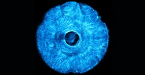 MIT develops 3D printed muscle that flexes like a human iris