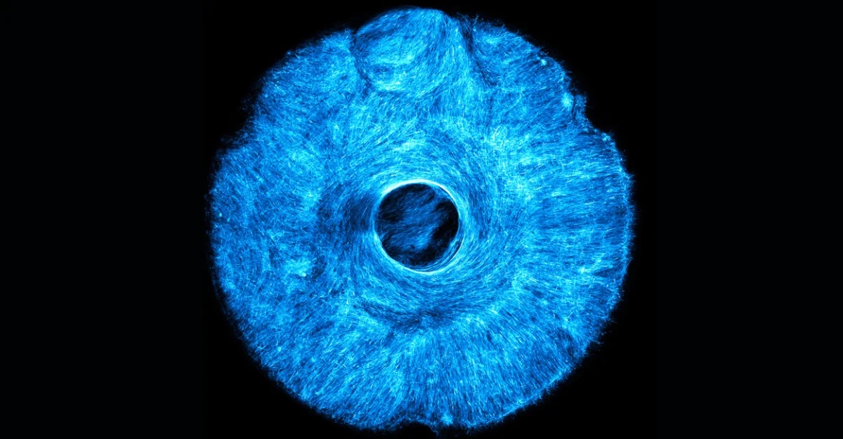 MIT develops 3D printed muscle that flexes like a human iris