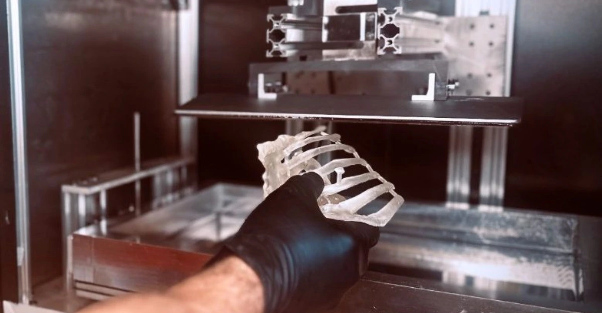 Meteora3D Accelerates 3D Printed Models for Surgeons